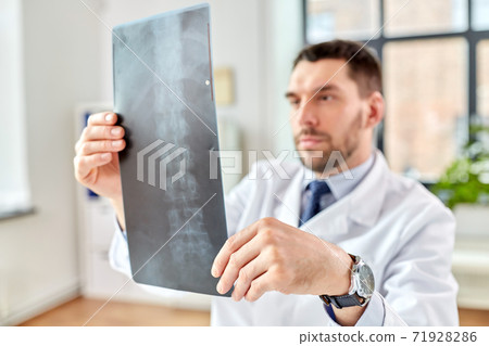male doctor with x-ray of spine at hospital male doctor with x-ray of spine at hospital 71928286