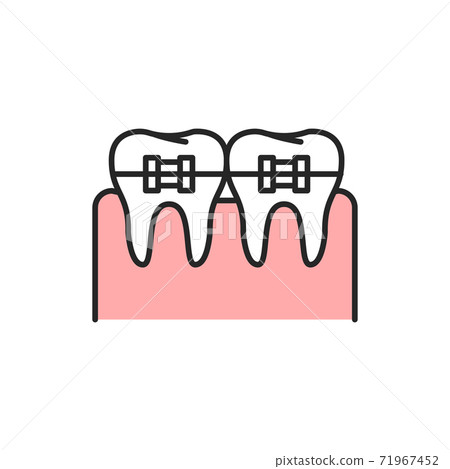 Teeth in braces color line icon. Pictogram for web page, mobile app, promo. 71967452