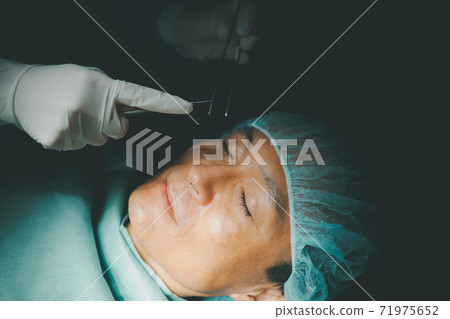 手術 外科的 人 71975652