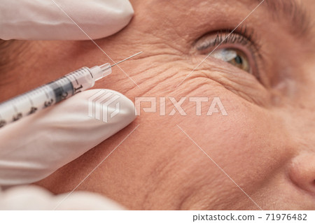 Cosmetologist hands in gloves holding syringe near female face 71976482