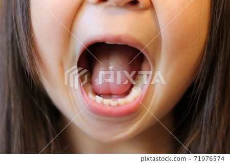 Children's teeth Children's teeth 71976574