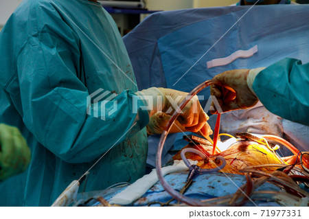 CloseUp heart surgeon doctor operation heart surgery intervention close-up replace valve open cord surgery minimally invasive surgery CloseUp heart surgeon doctor operation heart surgery intervention close-up replace valve open cord surgery minimally invasive surgery 71977331