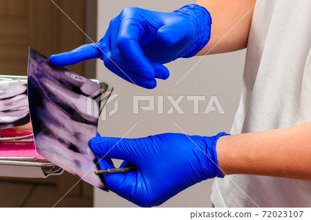 X-ray, the dentist holds an X-ray of the teeth, assesses the integrity of the teeth and nerve canals. X-ray, the dentist holds an X-ray of the teeth, assesses the integrity of the teeth and nerve canals. 72023107
