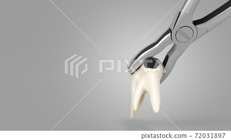 tooth clamped in medical extraction forceps dental services concept 3d render on grey gradient tooth clamped in medical extraction forceps dental services concept 3d render on grey gradient 72031897