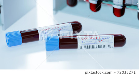 實驗室用冠狀病毒診斷試管 實驗室用冠狀病毒診斷試管 72033271