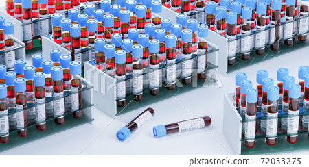 Laboratory with test tubes for coronavirus diagnosis 72033275