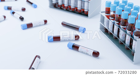 Laboratory with test tubes for coronavirus diagnosis 72033280