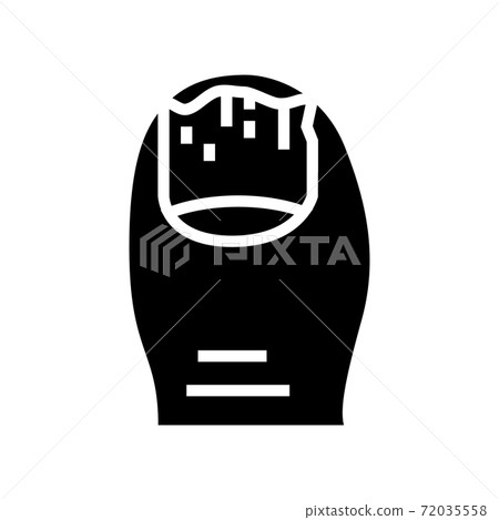 onychomycosis nail disease glyph icon vector illustration 72035558