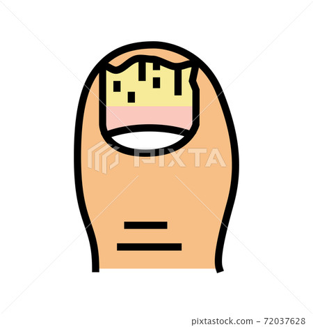 onychomycosis nail disease color icon vector illustration onychomycosis nail disease color icon vector illustration 72037628