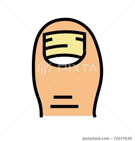 psoriasis nail disease color icon vector illustration psoriasis nail disease color icon vector illustration 72037630
