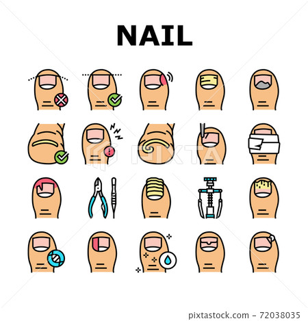 Ingrown Nail Disease Collection Icons Set Vector 72038035