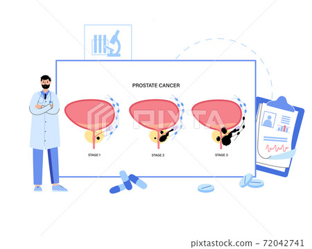 Man Reproducive System Problems 72042741