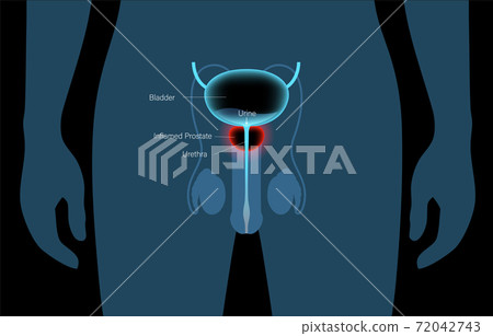 Normal bones concept 72042743