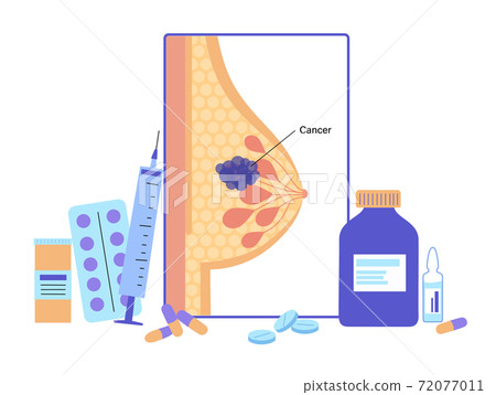Breast disease concept Breast disease concept 72077011