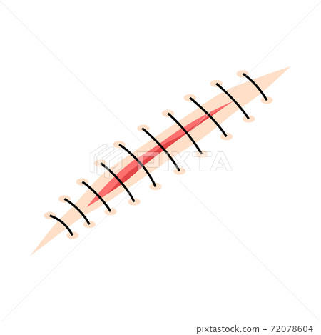 Cut suture scar vector icon. First aid injury stitch skin concept wound 72078604
