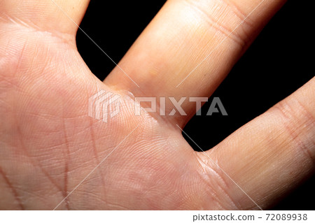 Close-up of lines on human skin as an abstract background. Close-up of lines on human skin as an abstract background. 72089938