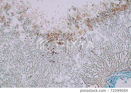 Penicillium, ascomycetous fungi are of major importance in the natural environment as well as food and drug production.  72099084