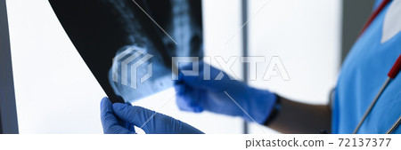 Doctor with gloves holds two x-rays closeup 72137377