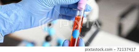 Gloved hands hold a test tube with virus liquid Gloved hands hold a test tube with virus liquid 72137417