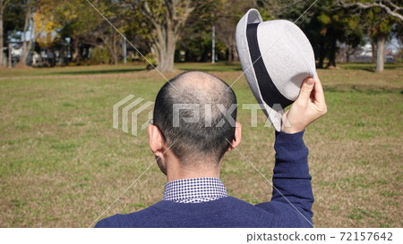 一名頭髮稀疏、剃著光頭的男子摘下帽子,向公園裡的人打招呼。 一名頭髮稀疏、剃著光頭的男子摘下帽子,向公園裡的人打招呼。 72157642