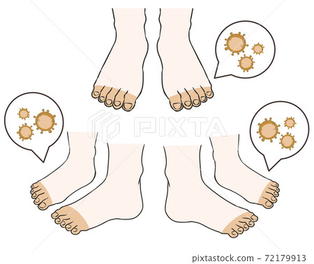 Foot white bacteria Foot white bacteria 72179913