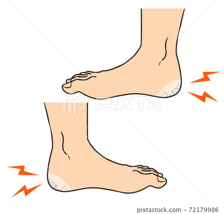 Foot ticking heel side 72179986