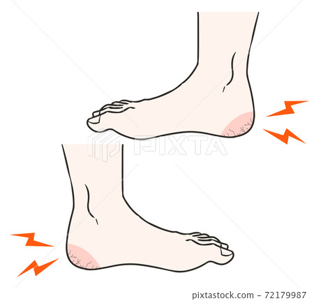 Feet white tick heel side 72179987