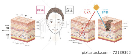 皮膚 斑 老化斑 72189393