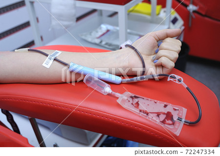 Taking blood from the vain of a donor. Arm on an armrest, hypodermic needle, tubes, container with blood Taking blood from the vain of a donor. Arm on an armrest, hypodermic needle, tubes, container with blood 72247334