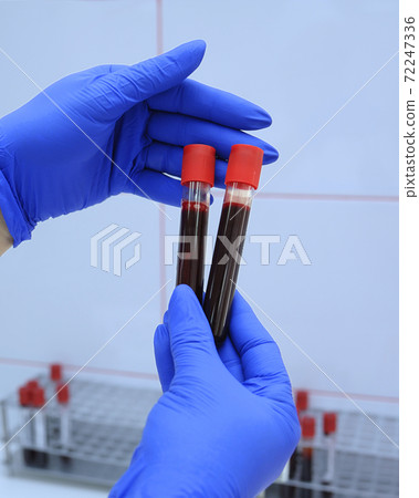 Lab assistant hands holding vacutainers with blood samples inside Lab assistant hands holding vacutainers with blood samples inside 72247336