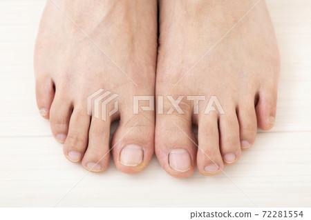 Toe 72281554
