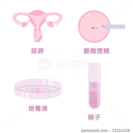 體外受精 72322236