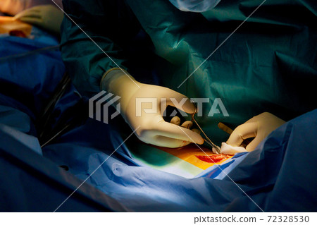 Patient with a cutting our incision a deeper human leg with bloody scar from surgery. Patient with a cutting our incision a deeper human leg with bloody scar from surgery. 72328530