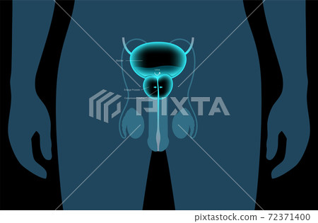 BPH info concept BPH info concept 72371400