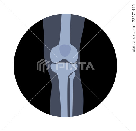 Normal bones concept 72371446