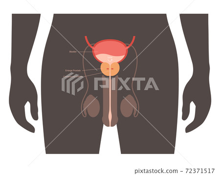 BPH info concept BPH info concept 72371517