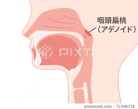 Illustration of head_sagittal section_adenoid_pharyngeal tonsil 72396718