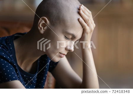 Close up sick hairless woman touch forehead, suffering from headache 72418348