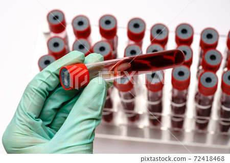 hands of a lab technician with a test tube of blood sample and a rack with other samples over light grey background hands of a lab technician with a test tube of blood sample and a rack with other samples over light grey background 72418468