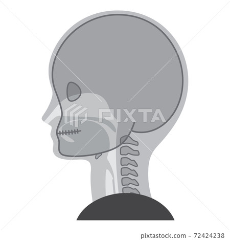 VF_Illustration of swallowing contrast examination_Swallowing VF_Illustration of swallowing contrast examination_Swallowing 72424238