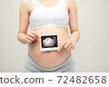 Pregnant girl shows an ultrasound photo of her undorn baby. Portrait of a child on an ultrasound photo 72482658