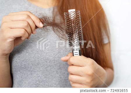 A woman with hair loss, she's allergic to shampoo and conditioner. 72491655