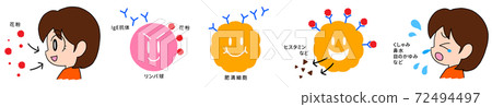 授粉和過敏機制概述:擠壓,鼻涕,眼睛發癢 授粉和過敏機制概述:擠壓,鼻涕,眼睛發癢 72494497