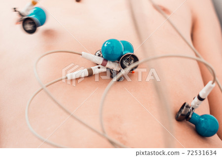 The nurse prepares the patient for the cardiogram, the cardiograph and the patient, the medical device for measuring the cardiogram. The nurse prepares the patient for the cardiogram, the cardiograph and the patient, the medical device for measuring the cardiogram. 72531634