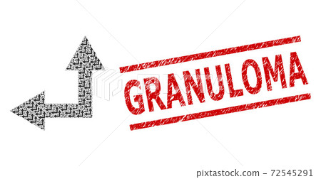Bifurcation Arrow Left Up Fractal Composition of Bifurcation Arrow Left Up Icons and Grunge Granuloma Seal Bifurcation Arrow Left Up Fractal Composition of Bifurcation Arrow Left Up Icons and Grunge Granuloma Seal 72545291