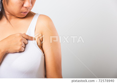 Woman pointing her skin underarm she problem armpit fat underarm wrinkled skin Woman pointing her skin underarm she problem armpit fat underarm wrinkled skin 72578940