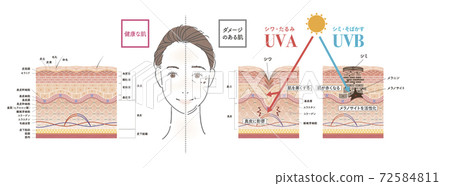 皮膚 斑 老化斑 72584811