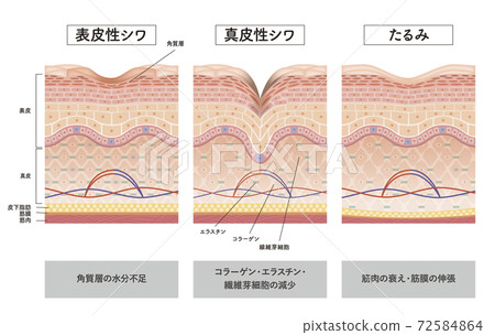 皮膚 人體皮膚 斷面圖 72584864