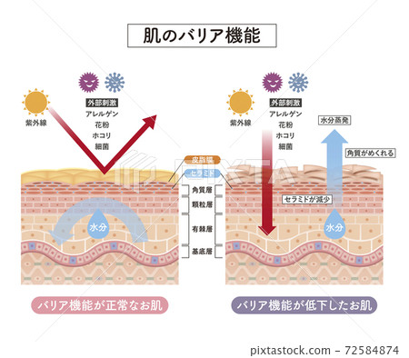 skin, skinned, cross-section diagram 72584874