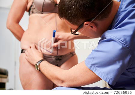 Doctor drawing marks on woman body before plastic surgery. Doctor drawing marks on woman body before plastic surgery. 72626956
